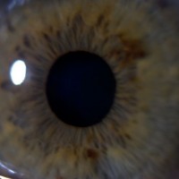 Eye