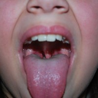 Inside the mouth