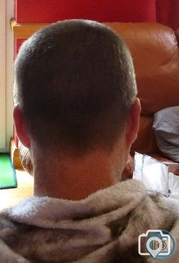 back of head