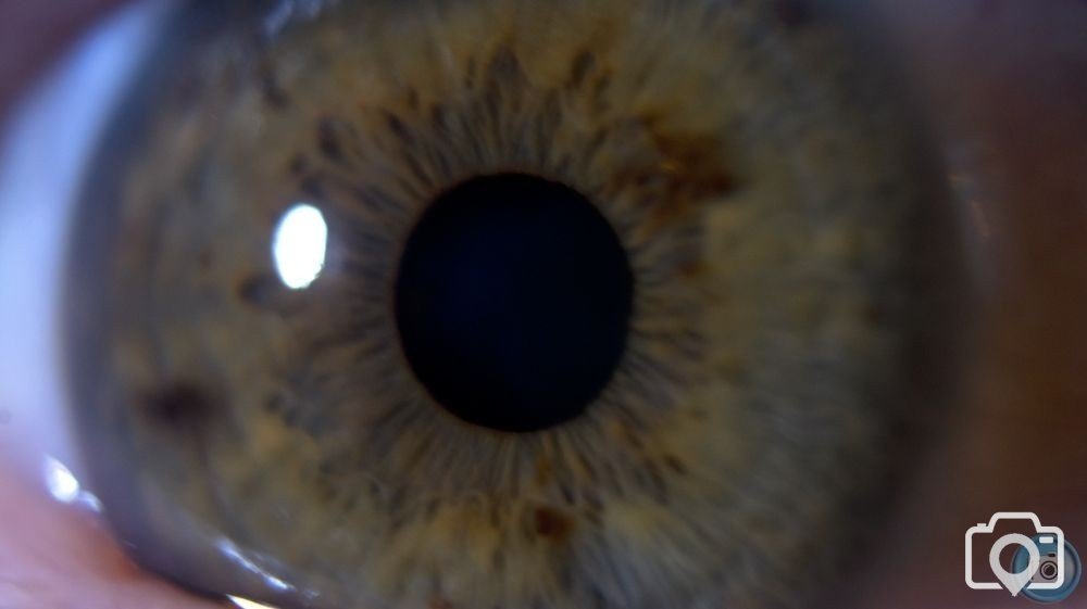 Eye