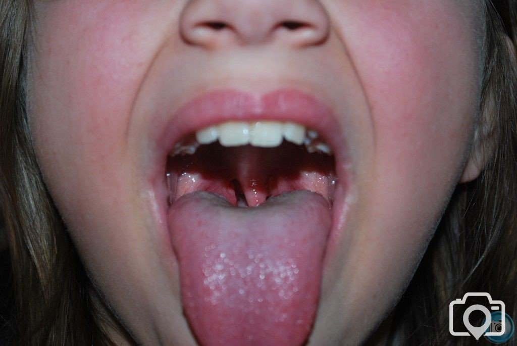 Inside the mouth